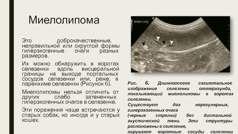 Диаметр Селезеночной Вены 8 Мм