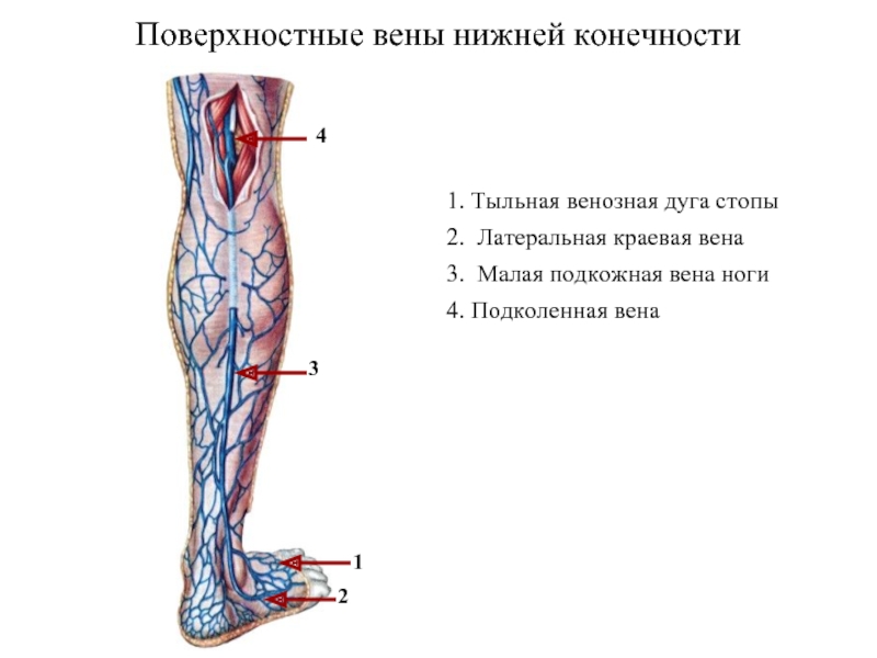 Варикозное Кровотечение Нижних Конечностей