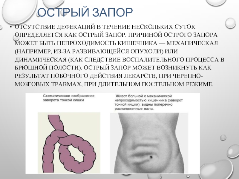 Варикоз Кишечника Диагностика