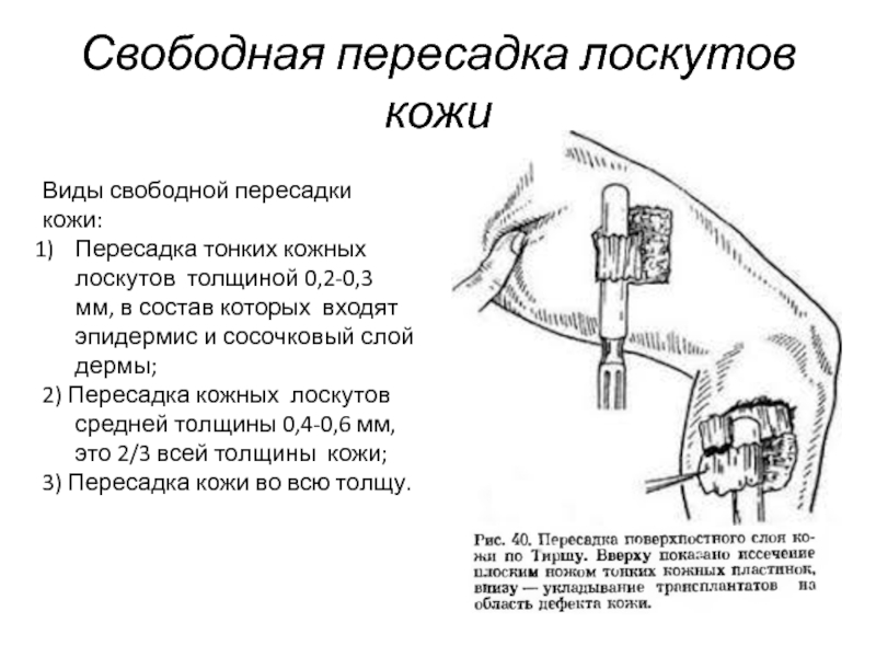 Режим Ротации В Вибраторе Это