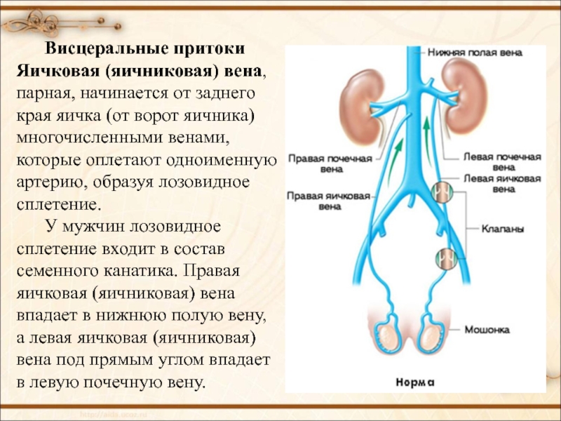 Варикоз Вен Яичника