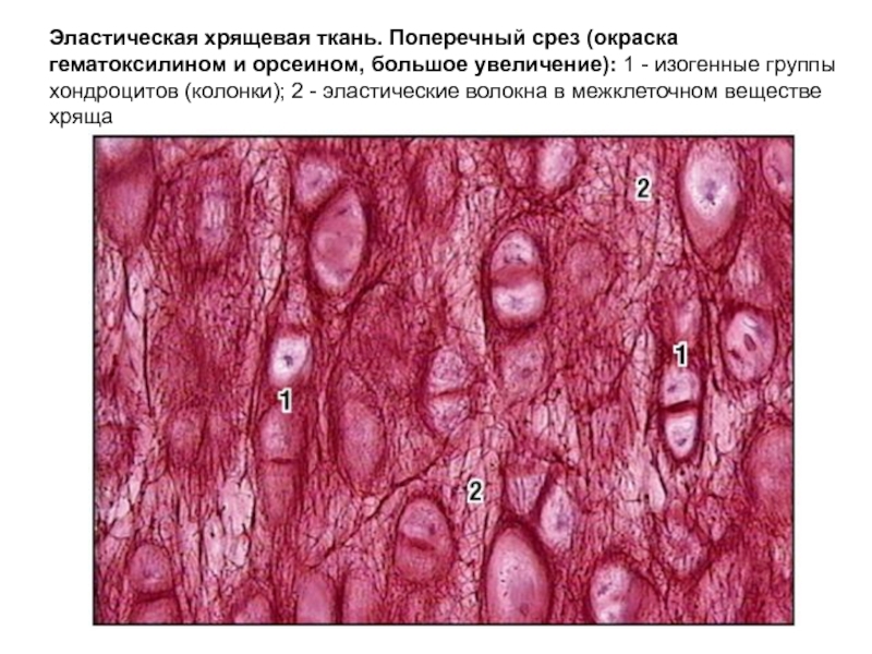 Эластический хрящ гистология рисунок