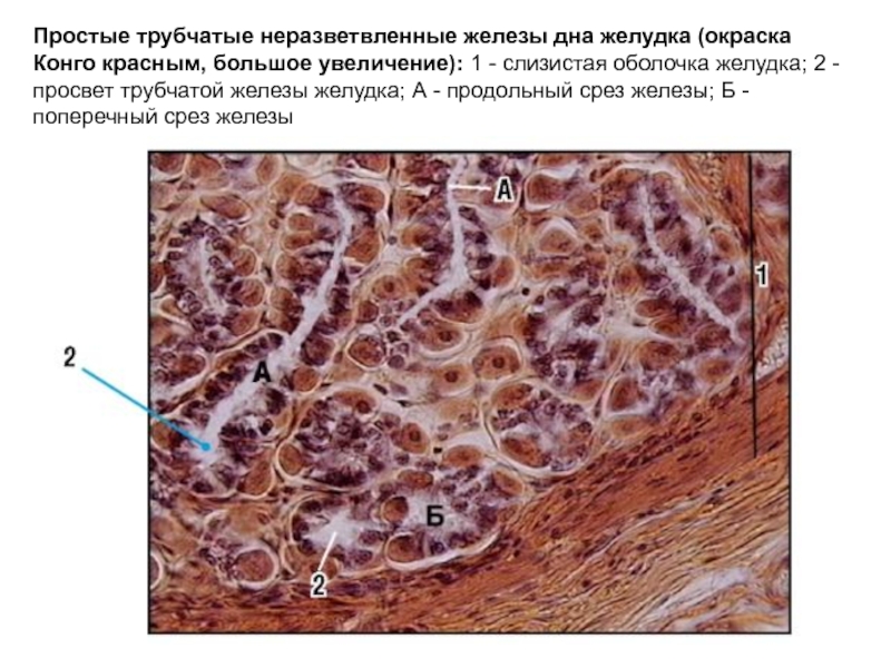 Простые трубчатые. Железы дна желудка гистология. Простые трубчатые железы дна желудка гистология. Простые трубчатые железы гистология препарат. Трубчатая железа желудка гистология.