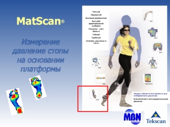 MatScan®