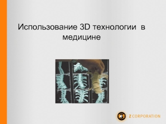 Использование 3D технологии  в  медицине