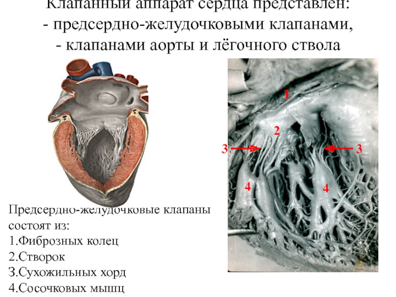 Скелет сердца. Предсердно желудочковые клапаны сердца. Створки левого предсердно-желудочкового клапана. Срез предсердно-желудочкового клапана. Сухожильные хорды сердца анатомия.