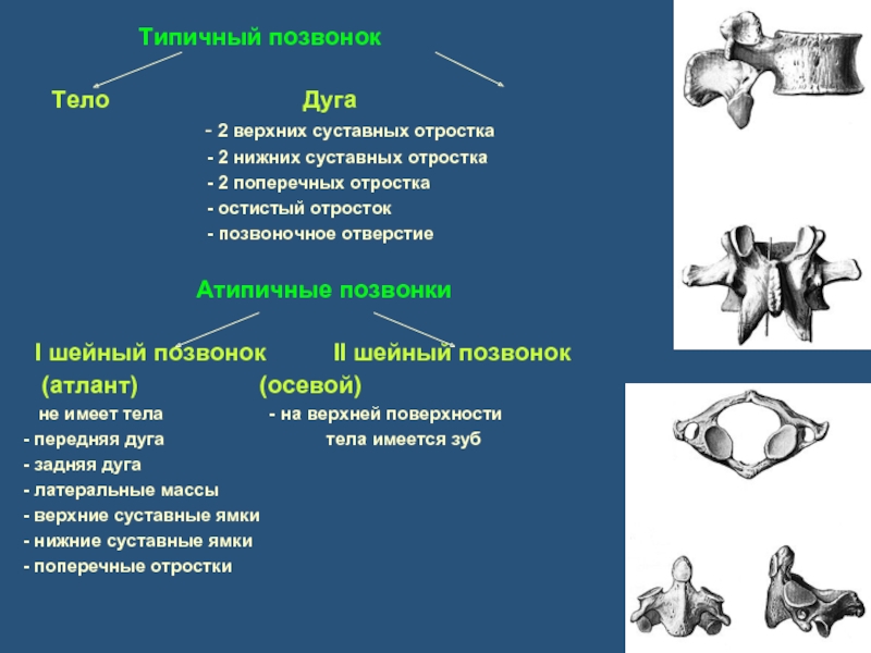 Дуга позвонка. Шейные позвонки типичные и атипичные. Типичный позвонок. Типичный позвонок имеет. Дуги позвонков.