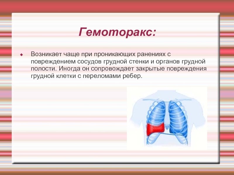 Травмы грудной клетки презентация