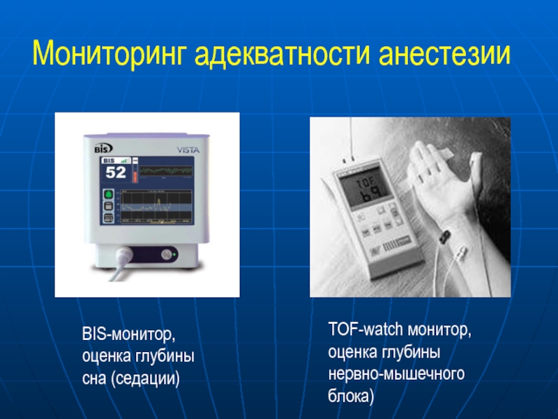 Мониторинг адекватности анестезии BIS-монитор, оценка глубины сна (седации) TOF-watch монитор, оценка глубины нервно-мышечного блока)