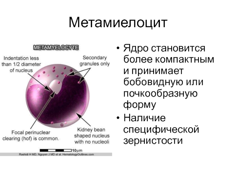 Метамиелоцит Ядро становится более компактным и принимает бобовидную или почкообразную форму Наличие специфической зернистости