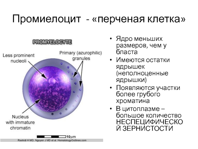 Промиелоцит - «перченая клетка» Ядро меньших размеров, чем у бласта Имеются остатки