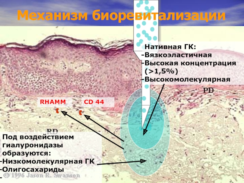 Механизм биоревитализацииНативная ГК:ВязкоэластичнаяВысокая концентрация (>1,5%)Высокомолекулярная Под воздействием гиалуронидазы образуются:Низкомолекулярная ГКОлигосахариды RHAMMCD 44