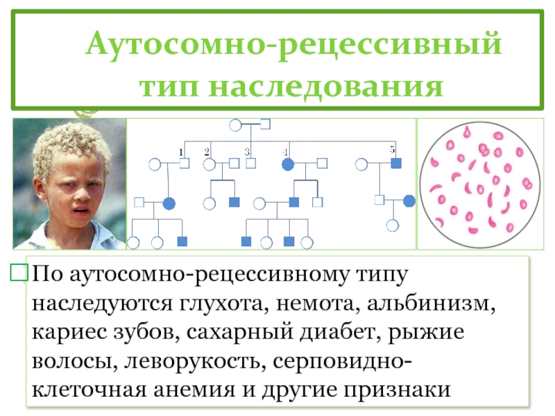 Аутосомно рецессивное наследование