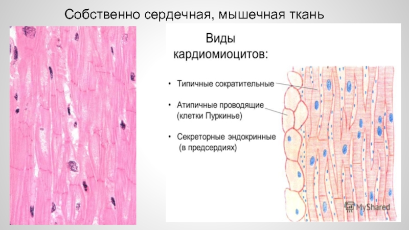 Сердечная мышечная ткань рисунок