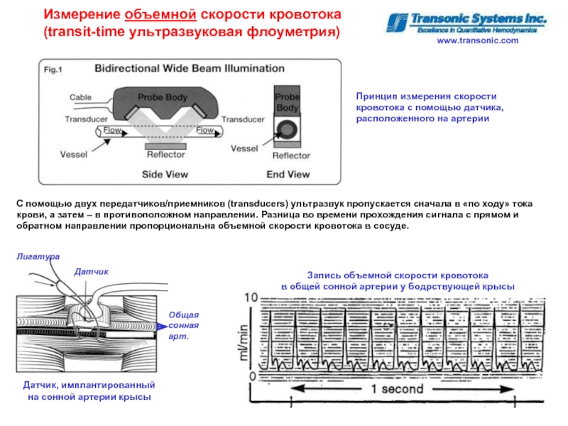 Измерение кровотока. Ультразвуковой метод измерения скорости кровотока. Ультразвуковой датчик измерения скорости потока крови. Ультразвуковая флоуметрия. Методы измерения объемной скорости кровотока.