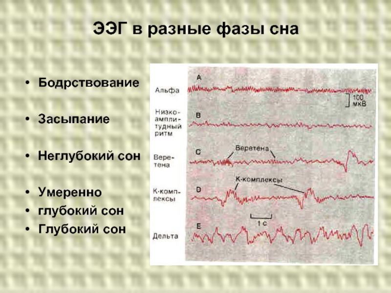 1 нарисовать схему стадий сна по данным ээг