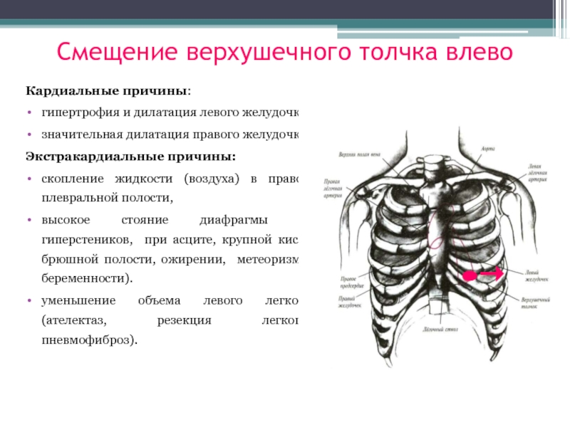 Верхушечный толчок