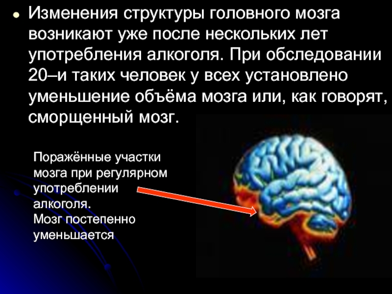 Изменения структуры головного мозга возникают уже после нескольких лет употребления алкоголя. При