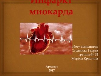 Инфаркт миокарда