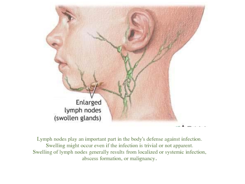 Swelling of lymph nodes... 