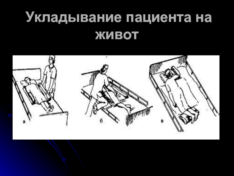 Различные положения. Укладывание пациента на живот. Укладывание пациента в положение на спине. Укладывание пациента в положение на животе. Укладывание пациента в положение симса.