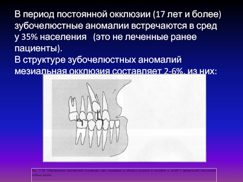 Постоянный период. Мезиальная окклюзия презентация. Зубочелюстные аномалии. Период постоянной окклюзии. Зубочелюстных аномалий прикусы.