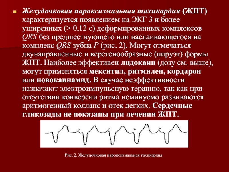 Презентация пароксизмальные тахикардии