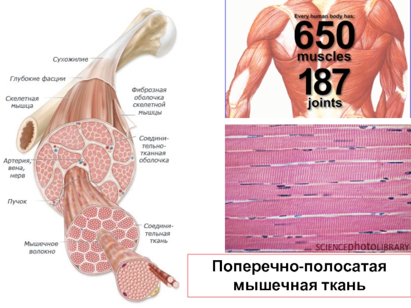 Мышечные аномалии. Диафрагма это поперечно-полосатая мышца. Полосатость мышц. Поперечно полосатые мышцы где. Поперечно полосатые мышцы у собак.