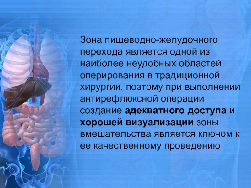 Пищеводно желудочный переход. Зона желудочного перехода. Пищеводно-желудочный переход операции. Антирефлюксной операции.