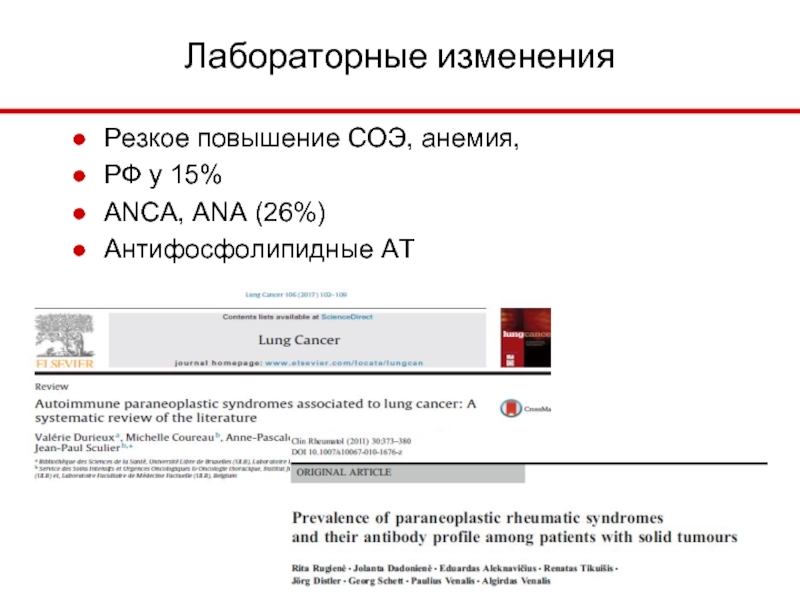 Лабораторные изменения Резкое повышение СОЭ, анемия,  РФ у 15% ANCA, ANA (26%) Aнтифосфолипидные АТ