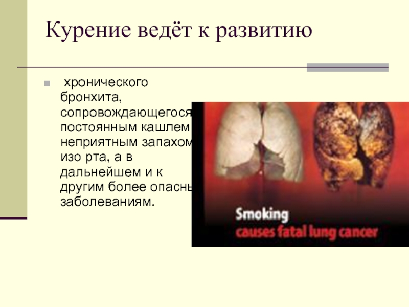 Курение ведёт к развитию хронического бронхита, сопровождающегося постоянным кашлем и неприятным