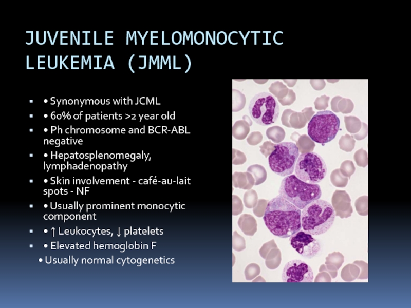 JUVENILE MYELOMONOCYTIC LEUKEMIA (JMML)• Synonymous with JCML• 60% of patients >2