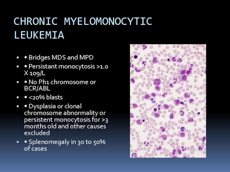 CHRONIC MYELOMONOCYTIC LEUKEMIA• Bridges MDS and MPD• Persistant monocytosis >1.0 X