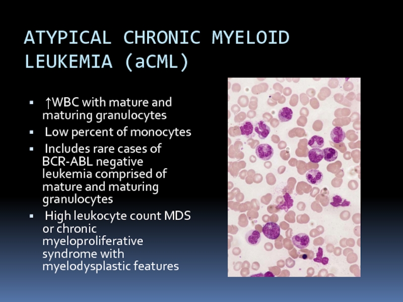 ATYPICAL CHRONIC MYELOID LEUKEMIA (aCML) ↑WBC with mature and maturing granulocytes