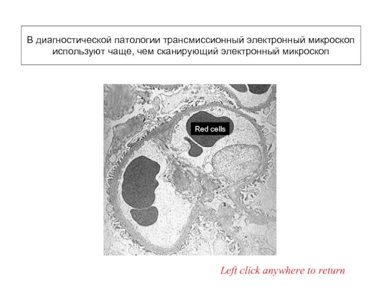 Red cellsLeft click anywhere to returnВ диагностической патологии трансмиссионный электронный микроскоп