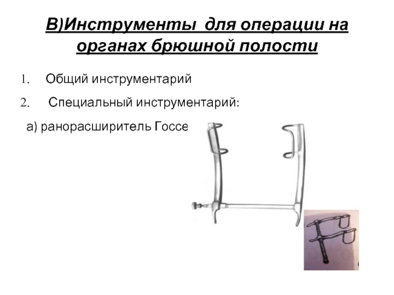 В)Инструменты для операции на органах брюшной полостиОбщий инструментарий Специальный инструментарий: а) ранорасширитель Госсе