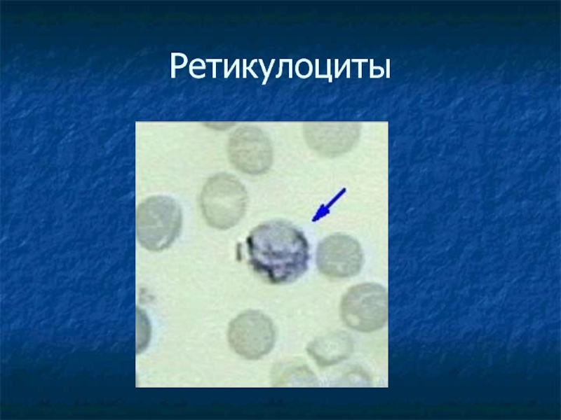Ретикулоциты повышены у мужчины. Ретикулоциты микроскопия. Ретикулоциты микроскопия норма. Пунктатные ретикулоциты. Ретикулоциты в микроскопе.