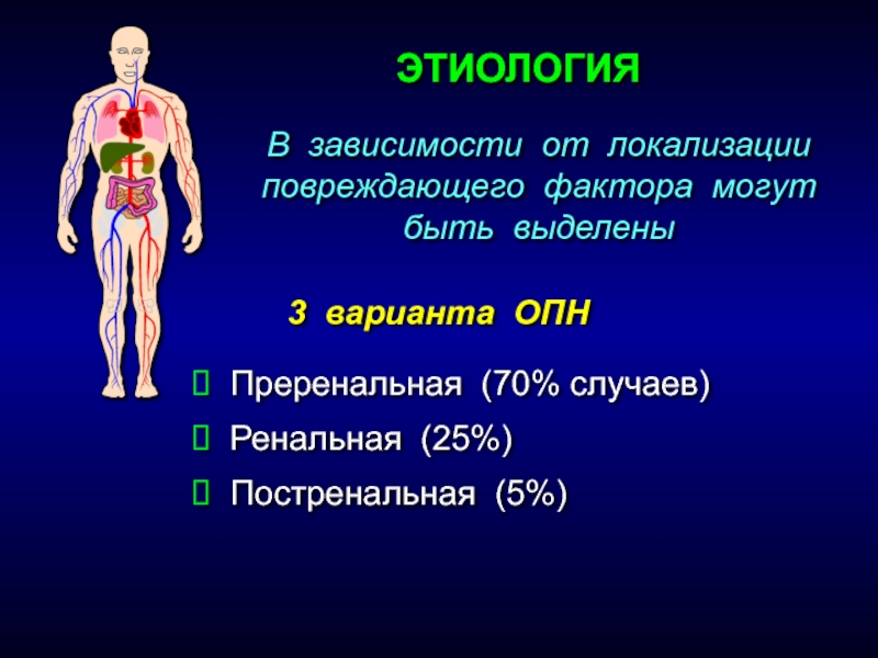 Преренальная (70% случаев) Ренальная (25%) Постренальная (5%)ЭТИОЛОГИЯ В зависимости от