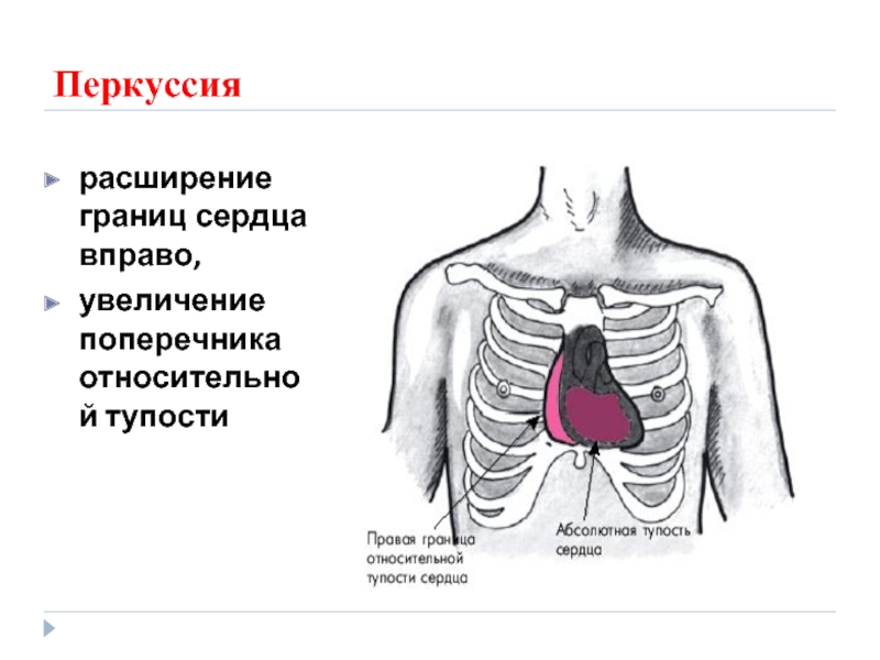 Границы сердца фото