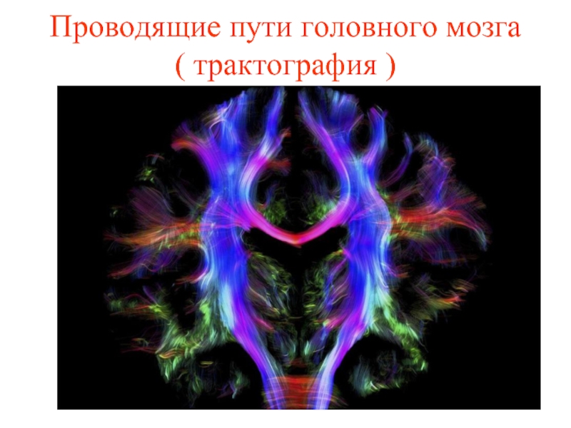 Проводящие пути головного мозга  ( трактография )