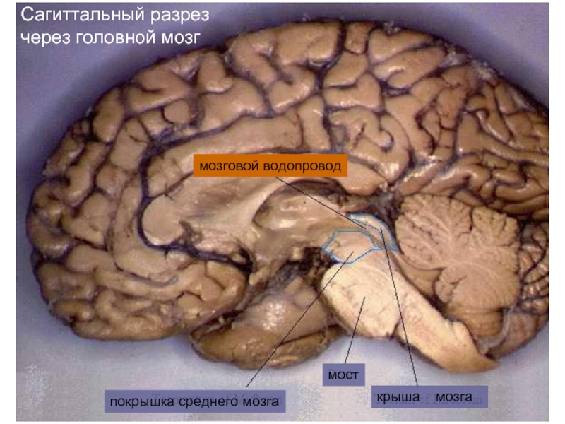 Мозги на ножках. Вентральная покрышка мозга. Покрышка мозга анатомия. Покрышка среднего мозга анатомия. Ядра покрышки среднего мозга.