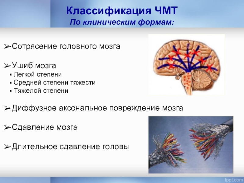 Классификация ЧМТ По клиническим формам:Сотрясение головного мозгаУшиб мозга Легкой степени Средней