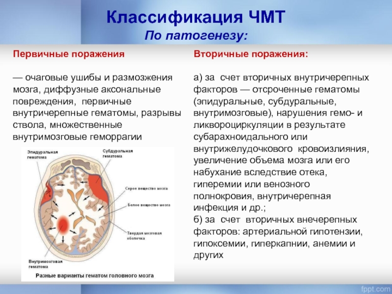 Классификация ЧМТ По патогенезу:Первичные поражения— очаговые ушибы и размозжения мозга, диффузные