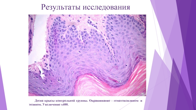 Увеличение х. Собственная пластинка десны. Очаговый склероз собственной пластинки желудка. Гипофиз окраска гематоксилином и Азина большое увеличение. Висмут механизм окрашивания десны.