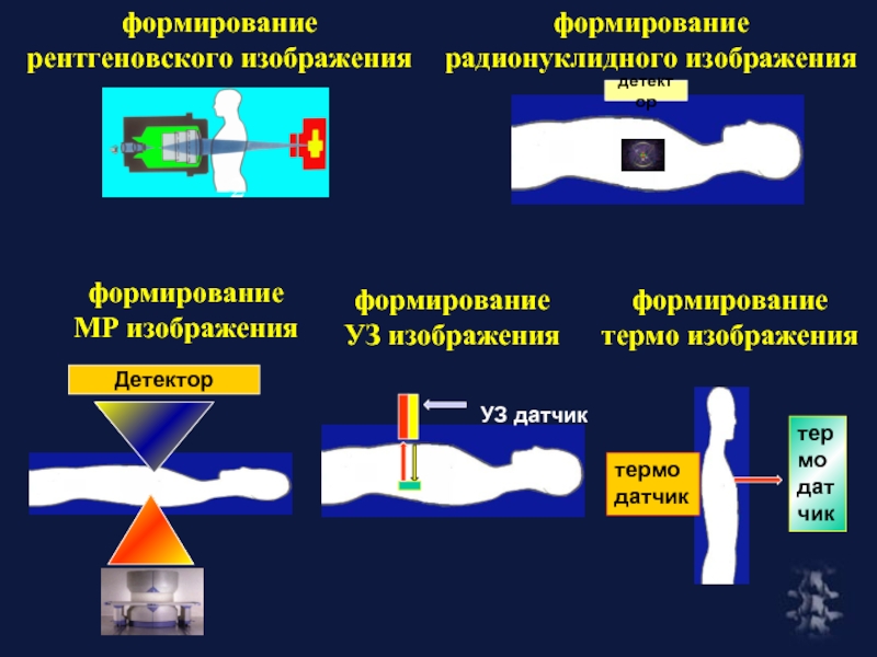 Формирования изображения на экран. Формирование рентгеновского изображения. Схема формирования рентгеновского изображения. Формирование рентгеноскопического изображения.. Закономерности формирования рентгеновского изображения.