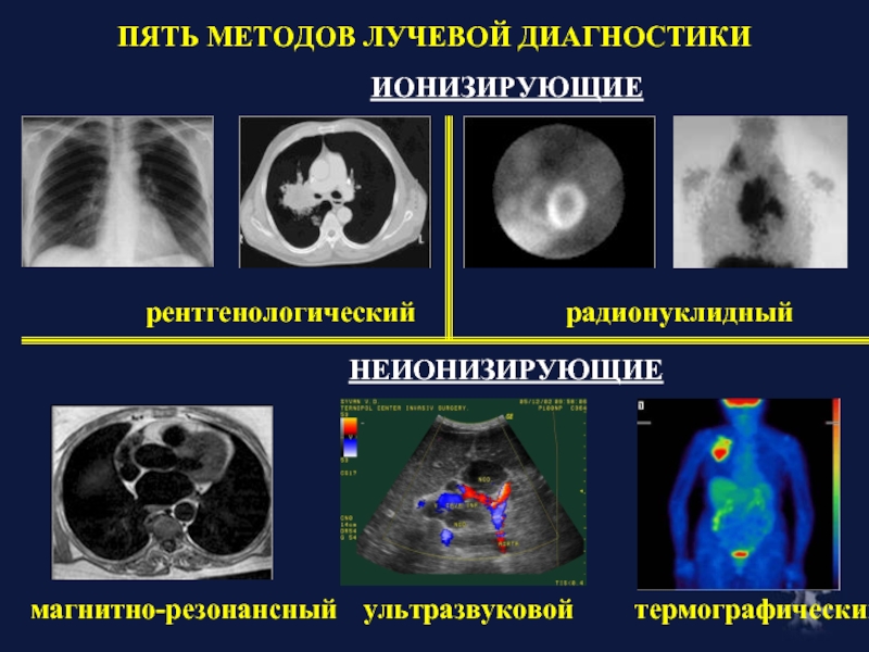 Методы лучевой диагностики презентация