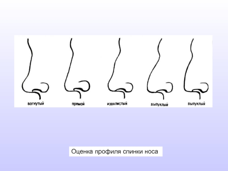 Оценка профиля спинки носа