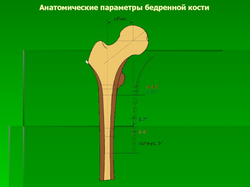 Схема бедренной кости