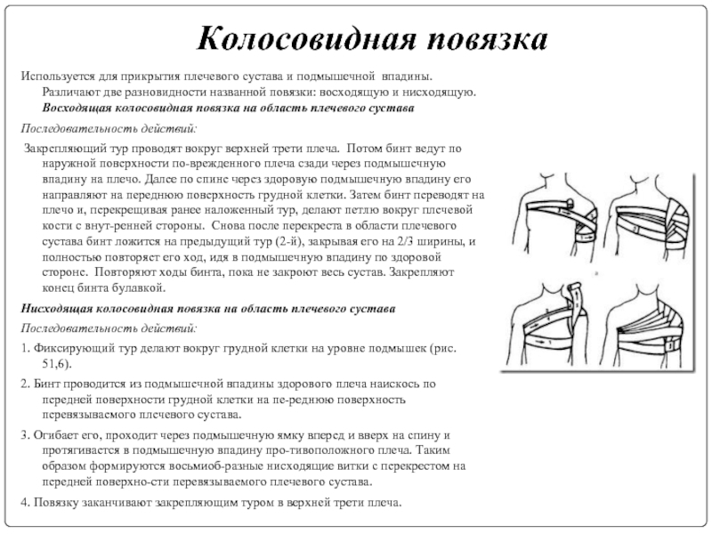 Колосовидная повязка. Колосовидная повязка на плечевой сустав алгоритм. Нисходящая колосовидная повязка. Колосовидная повязка на плечевой сустав показания. Наложение колосовидной повязки на плечевой сустав алгоритм.