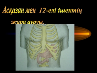 Жара ауруының этиологиясында. Helicobacter pilori бактериясының орны өте маңызды
